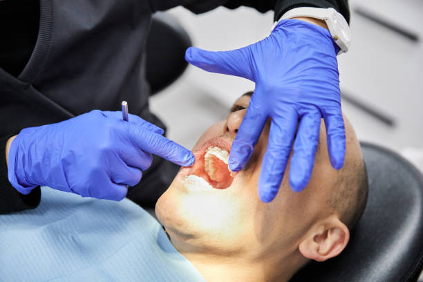 Best Emergency Root Canal Treatment in Nappanee, IN